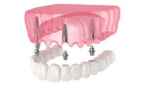 dental-1