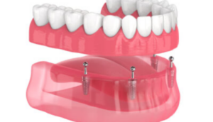 dental-3