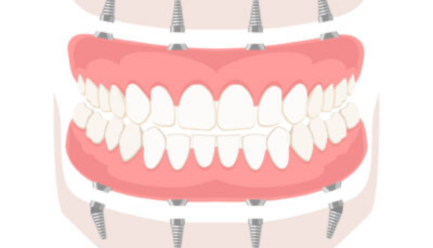 dental-4