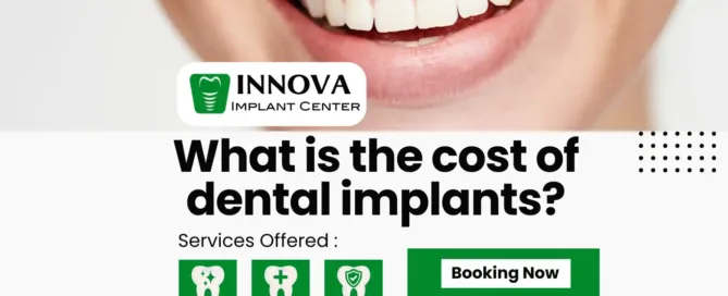what-is-the-cost-of-dental-implants-alexandria-implants-near-me-same-day