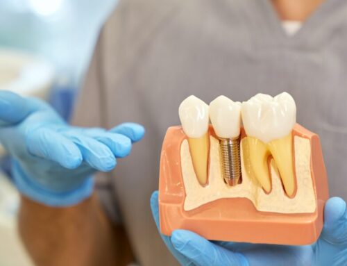 Am I a Candidate for Dental Implants?